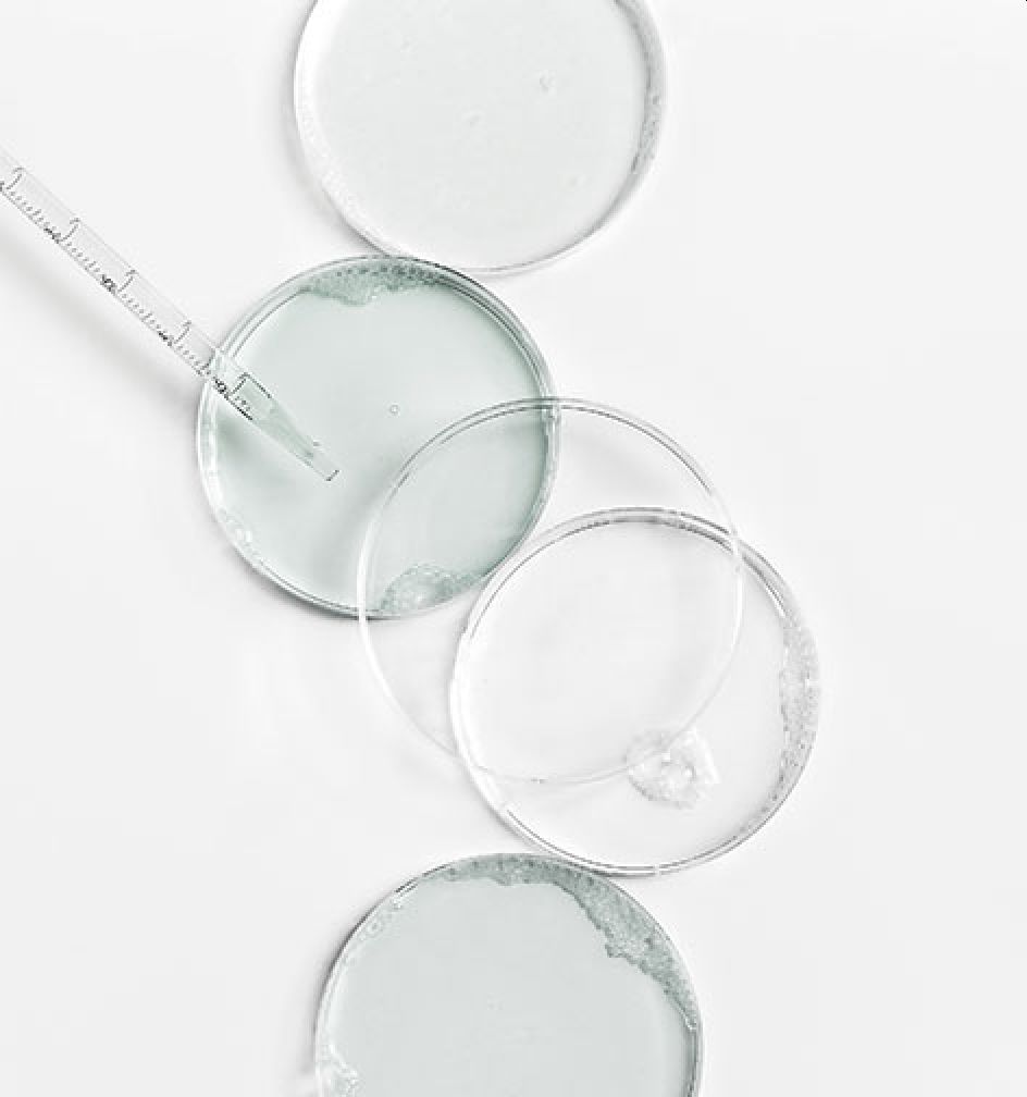 Zwei Petrischalen mit weisser Flüssigkeit und zwei mit hellgrünlicher Flüssigkeit und eine Pipette
